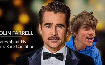 What is Angelman Syndrome? Colin Farrell Shares about his Son’s Rare Condition Weborik News Image